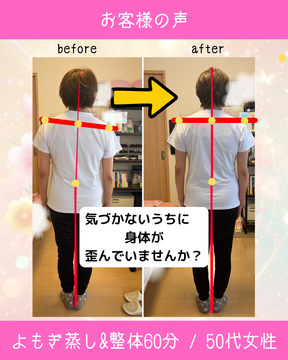 痛くない！
顔までスッキリしてない？！　顔は触ってないのにねー！